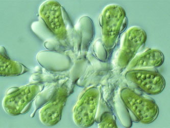 Botryococcus braunii. Изображение с сайта www.shigen.nig.ac.jp