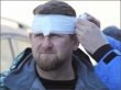 Самбист разбил лицо Кадырову