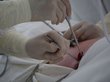 Хирурги Алтайского края впервые провели пересадку сердца
