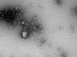«Вектор» первым в мире сфотографировал британский штамм коронавируса