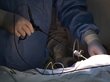 Малыша с аномально скрученным ухом прооперировали в Томске