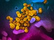 Названы симптомы нового штамма коронавируса «лямбда»