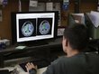 Ученые впервые просканировали мозг умирающего человека