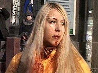 Анна Шавенкова сразу после аварии