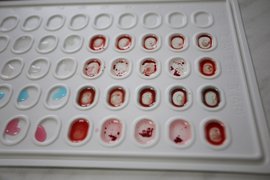 Типирование групп крови