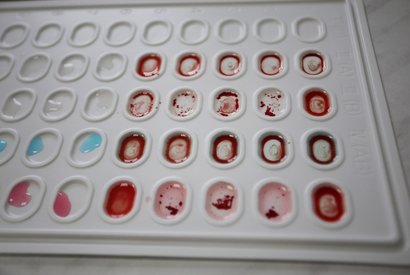 Типирование групп крови