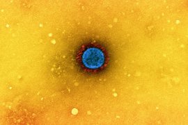 Коронавирус SARS-CoV-2 под микроскопом