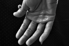 Потливость